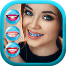 Braces Photo Editor Free APK