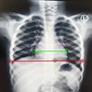 CT Ratio-Xray APK