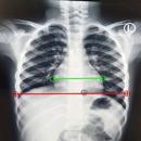 CT Ratio-Xray APK