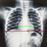 CT Ratio-Xray APK