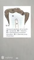 Dental AR screenshot 2