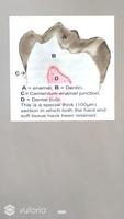 Dental AR screenshot 3