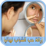 إزالة حب الشباب نهائيا بدون نت ícone