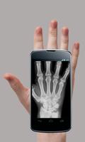 Scanner X-Ray Prank Affiche