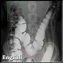 Digestive System exam question APK