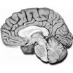 NeuroAnatomía preguntas examen