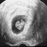 Obstetricia en preguntas