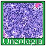 Oncología preguntas de examen