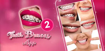 Teeth Braces App 2