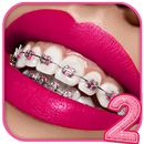 Teeth Braces App 2 APK