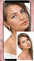 Freckles Filter Camera পোস্টার