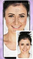 Freckles Filter Camera স্ক্রিনশট 2