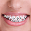 Niềng răng giả Máy ảnh với Dán ảnh cho Răng