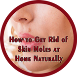 How to Get Rid of Skin Moles at Home Naturally