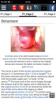 Cervix : Educational App screenshot 2