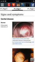 Chlamydia : STD Facts Ekran Görüntüsü 1