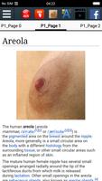 Warzenhof - Areola Screenshot 1