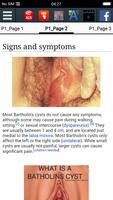 Bartholin's cyst Ekran Görüntüsü 2