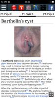 Bartholin's cyst :EducationApp screenshot 1