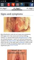 Bartholin's cyst :EducationApp screenshot 2