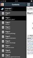 Bartholin's gland poster