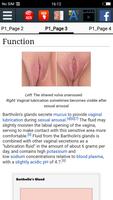 Bartholin's gland screenshot 2