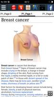 Breast cancer ảnh chụp màn hình 1