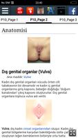 Kadın üreme organları Ekran Görüntüsü 2