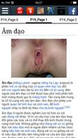 Âm đạo ảnh chụp màn hình 1