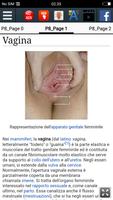 1 Schermata Vagina