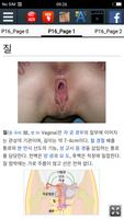 질 스크린샷 1