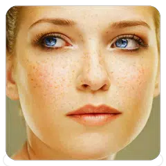 Freckles Tips