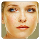 Freckles Tips
