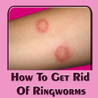 How To Get Rid Of Ringworms иконка