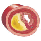 Cholesterol icône