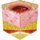 Pressure Ulcer Guide icon