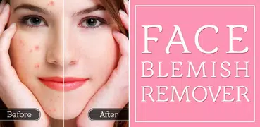 Face Blemish Remover - Smooth 