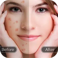 Face Blemish Remover - Smooth  APK download