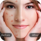 Face Blemish Remover - Smooth  آئیکن