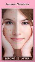 Face Blemish Remover - Smooth  پوسٹر