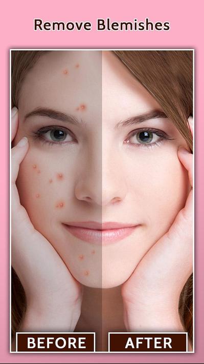 Face Blemish Remover - Smooth Skin & Beautify Face poster