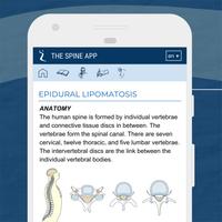 2 Schermata THE SPINE APP