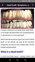 所有牙科疾病 截图 3