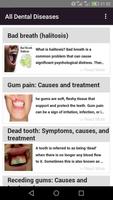 치과 질환 포스터