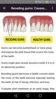치과 질환 스크린샷 2