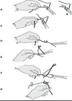 Surgery Stitching Techniques پوسٹر