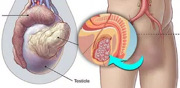 প্রস্রাবে সমস্যার চিকিৎসা ~ Urinary Infection Tips