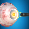 The Eye (Anatomy & Physiology) APK