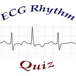 ECG Rhythm Quiz