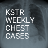 KSTR Weekly Chest Cases simgesi
